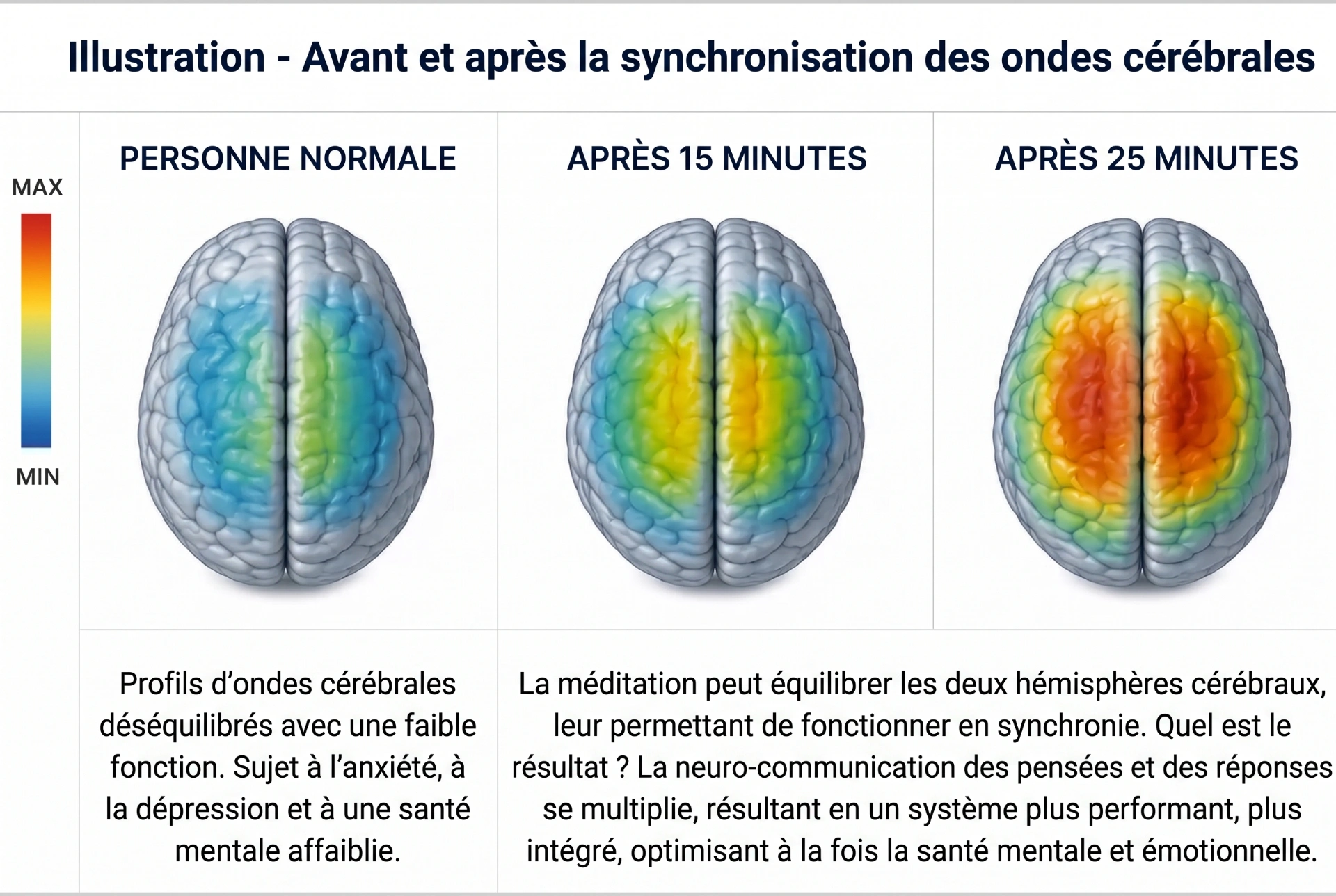 Illustration : avant et après la synchronisation des ondes cérébrales